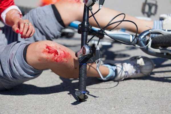 自行车撞跑车（自行车撞人轻微伤一般赔多少）-图3