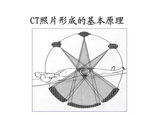 平行ct原理（平面ct）-图2